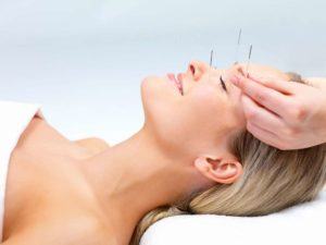 acupuntura-facial